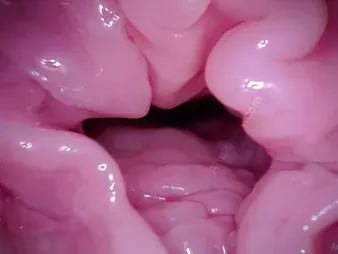 Watch Fluff Coaster's Labia get a camera helter-skelter POV - A hymen charm video!